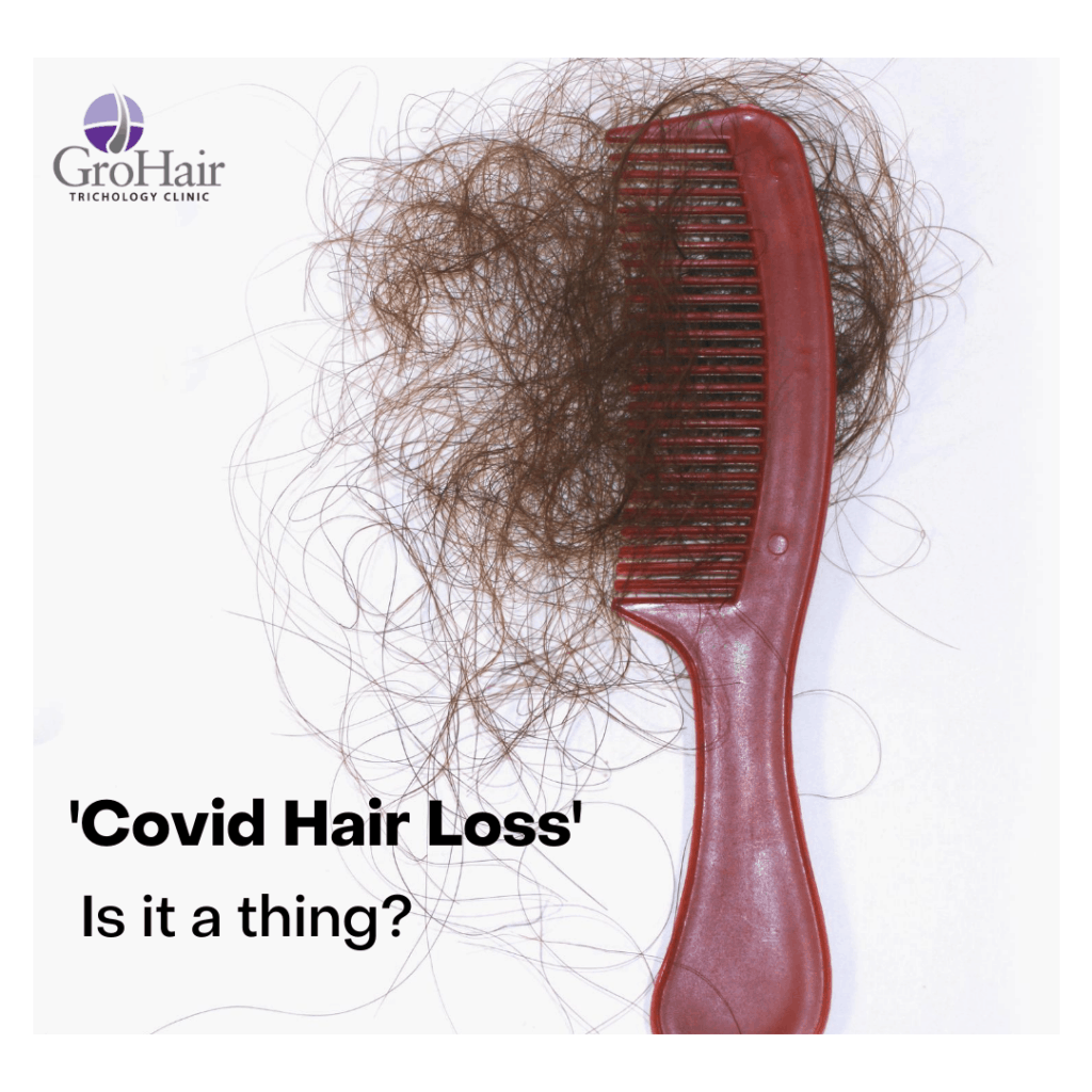 Covid-19 related hair loss